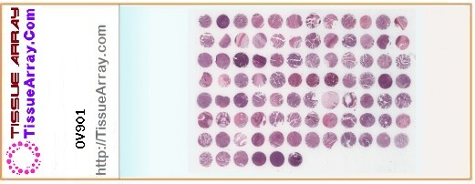 TissueArray.Com Tissue Array OV901