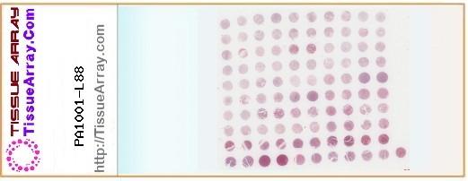 TissueArray.Com Tissue Array PA1001-L88