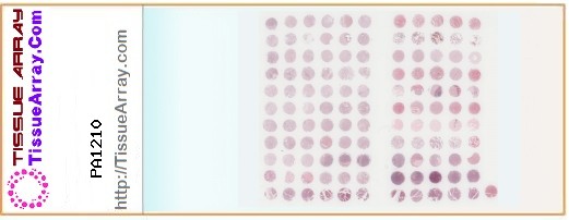 TissueArray.Com Tissue Array PA1210