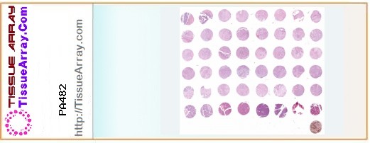 TissueArray.Com Tissue Array PA482