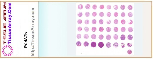 TissueArray.Com Tissue Array PA482b