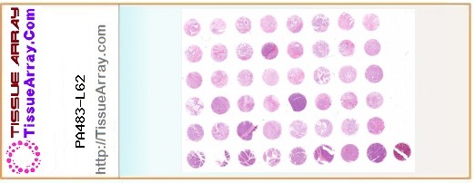 TissueArray.Com Tissue Array PA483-L62