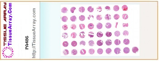 TissueArray.Com Tissue Array PA486