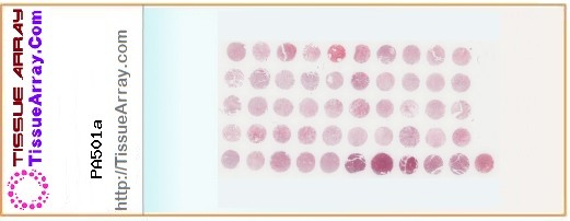 TissueArray.Com Tissue Array PA501a