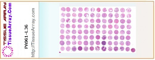 TissueArray.Com Tissue Array PA961-L36
