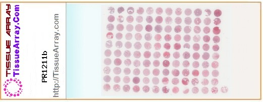TissueArray.Com Tissue Array PR1211b