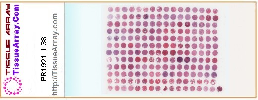 TissueArray.Com Tissue Array PR1921-L38