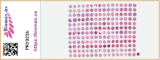 TissueArray.Com Tissue Array PR1921b