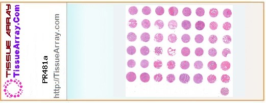TissueArray.Com Tissue Array PR481a