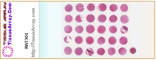 TissueArray.Com Tissue Array RAT301