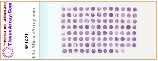 TissueArray.Com Tissue Array RE1021