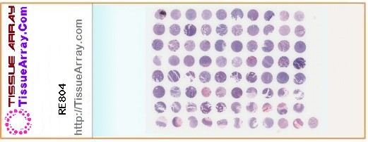 TissueArray.Com Tissue Array RE804