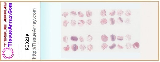 TissueArray.Com Tissue Array RS321a