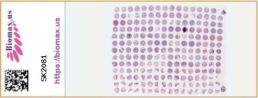 TissueArray.Com Tissue Array SK2081