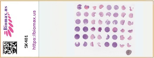 TissueArray.Com Tissue Array SK481