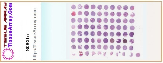 TissueArray.Com Tissue Array SK801c
