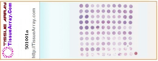 TissueArray.Com Tissue Array SO1001a