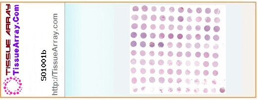 TissueArray.Com Tissue Array SO1001b