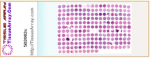 TissueArray.Com Tissue Array SO2082c