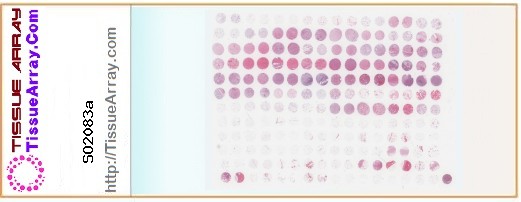 TissueArray.Com Tissue Array SO2083a