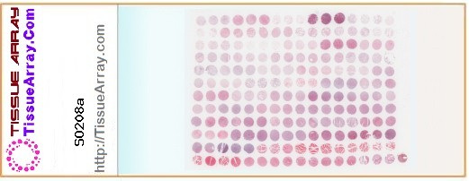 TissueArray.Com Tissue Array SO208a