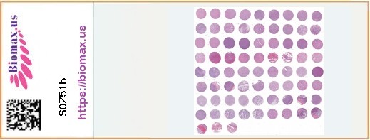 TissueArray.Com Tissue Array SO751b