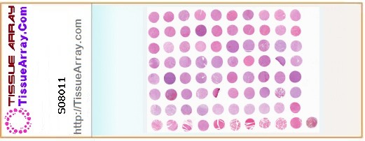 TissueArray.Com Tissue Array SO8011