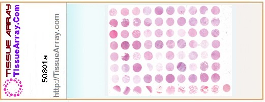 TissueArray.Com Tissue Array SO801a