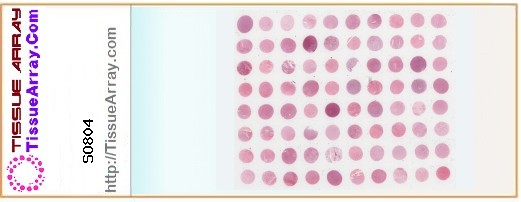 TissueArray.Com Tissue Array SO804