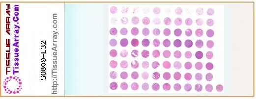 TissueArray.Com Tissue Array SO809-L32