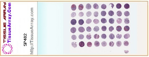 TissueArray.Com Tissue Array SP482