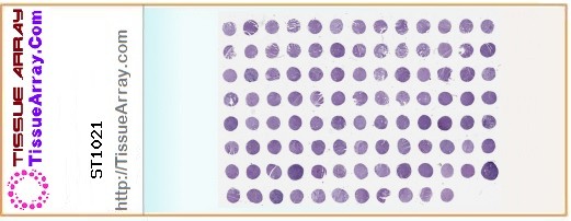 TissueArray.Com Tissue Array ST1021