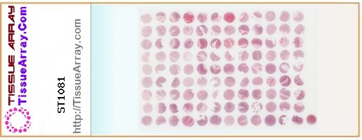 TissueArray.Com Tissue Array ST1081