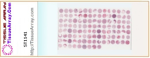 TissueArray.Com Tissue Array ST1141