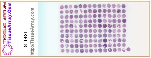 TissueArray.Com Tissue Array ST1401