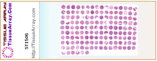 TissueArray.Com Tissue Array ST1506