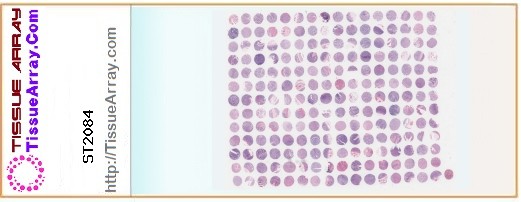 TissueArray.Com Tissue Array ST2084