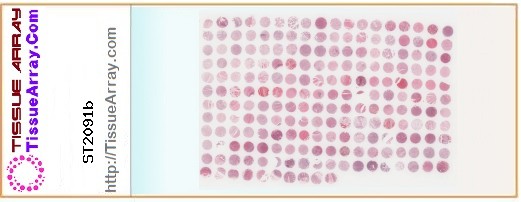 TissueArray.Com Tissue Array ST2091b