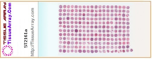 TissueArray.Com Tissue Array ST2161a