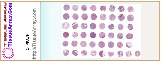 TissueArray.Com Tissue Array ST483f