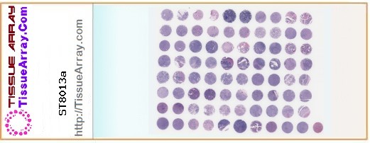 TissueArray.Com Tissue Array ST8013a