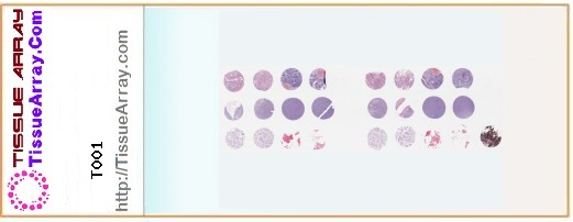 TissueArray.Com Tissue Array T001