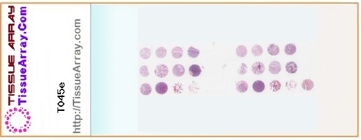 TissueArray.Com Tissue Array T045e