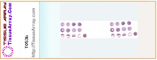 TissueArray.Com Tissue Array T053b