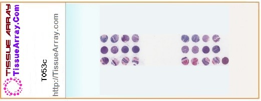 TissueArray.Com Tissue Array T053c