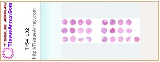 TissueArray.Com Tissue Array T054-L32