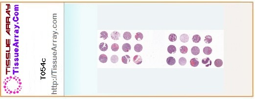 TissueArray.Com Tissue Array T054c