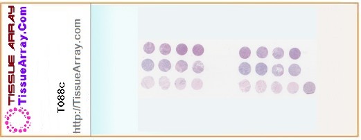 TissueArray.Com Tissue Array T088c