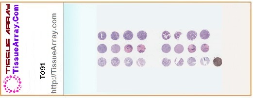 TissueArray.Com Tissue Array T091