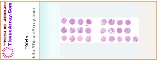 TissueArray.Com Tissue Array T094a